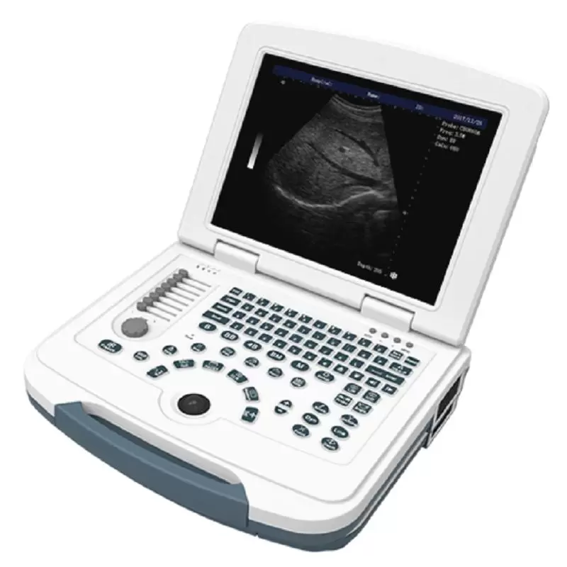 Diagnostic Equipment - Ultrasound Scanner